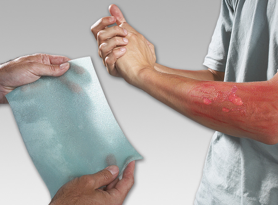 Hydrogel BURNFREE Beutel 20 x 3,5 g